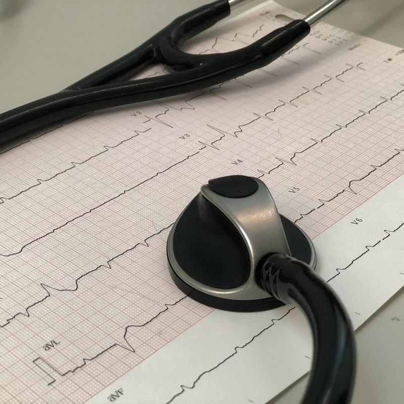 Espirometría - Electrocardiograma